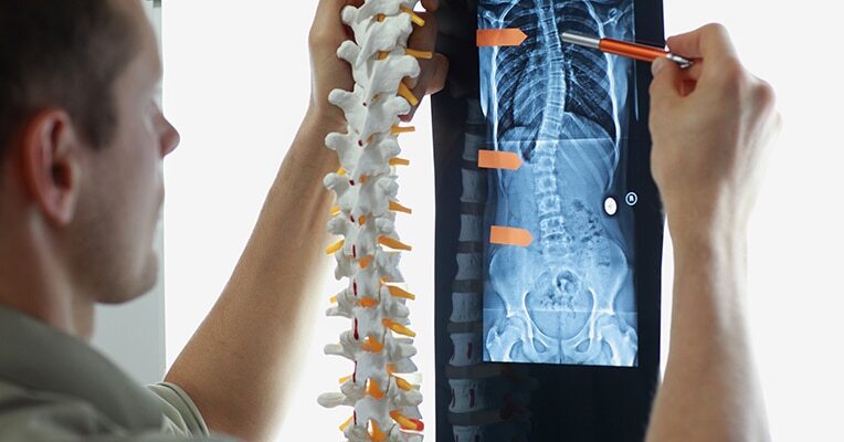 Alton Illinois Spinal Cord Injury Lawyers