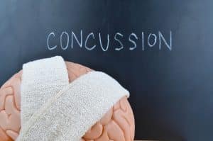 Why Concussions Are Anything But “Mild” Brain Injuries 