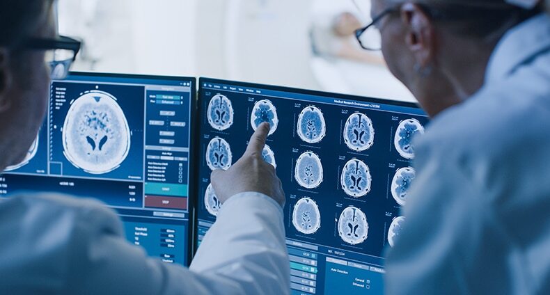 Carlinville Traumatic Brain Injury Attorneys
