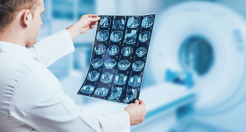 Jerseyville Traumatic Brain Injury Attorneys