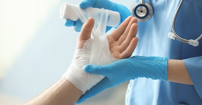Alton Illinois Burn Injury Lawyers