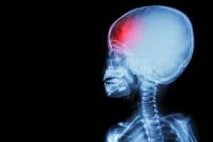 What Parents Should Know About Pediatric Brain Injuries